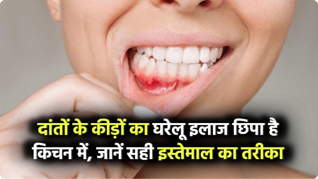 दांतों में कीड़ा खत्म करने के लिए किचन में छिपा है ये घरेलू इलाज, जानिए इस्तेमाल का सही तरीका Teeth Cavity Home Remedy
